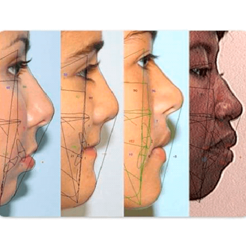 ortopedia-facial-integra-odontologia-